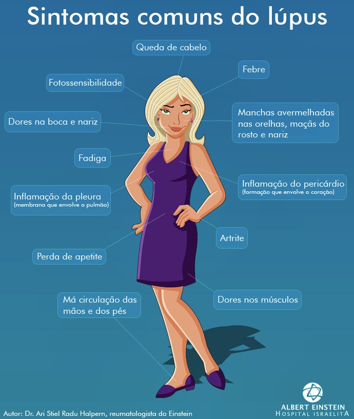 articulatie plastica